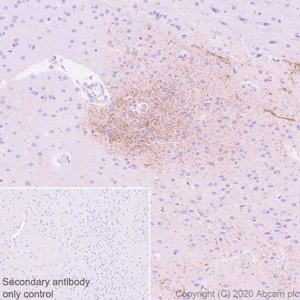 Immunohistochemistry (Formalin/PFA-fixed paraffin-embedded sections) - Anti-CRF antibody [EPR23255-162] (AB272391)