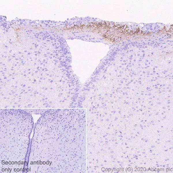 Immunohistochemistry (Formalin/PFA-fixed paraffin-embedded sections) - Anti-CRF antibody [EPR23255-162] - BSA and Azide free (AB272397)
