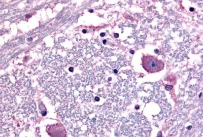 Immunohistochemistry (Formalin/PFA-fixed paraffin-embedded sections) - Anti-CRF1/CRHR1 antibody (AB150561)