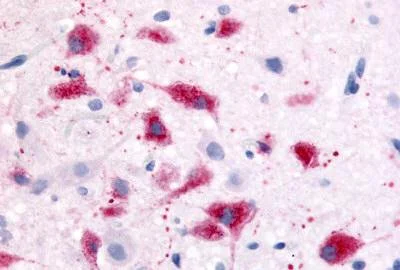 Immunohistochemistry (Formalin/PFA-fixed paraffin-embedded sections) - Anti-CRF1/CRHR1 antibody (AB150561)