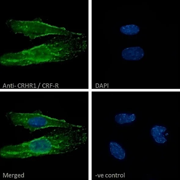 Immunocytochemistry/ Immunofluorescence - Anti-CRF1/CRHR1 antibody (AB77686)