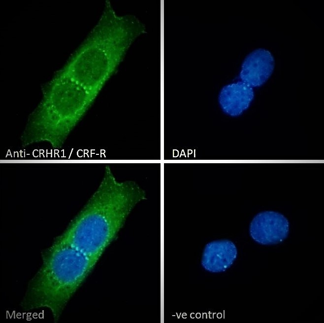 Immunocytochemistry/ Immunofluorescence - Anti-CRF1/CRHR1 antibody (AB77686)