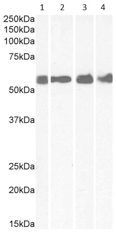 Western blot - Anti-CRF1/CRHR1 antibody (AB77686)