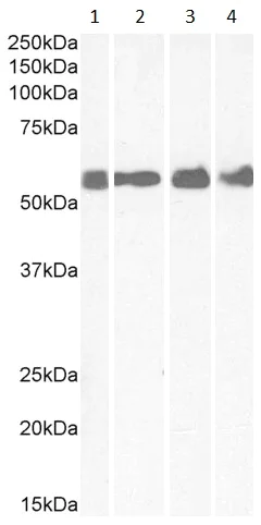 Western blot - Anti-CRF1/CRHR1 antibody (AB77686)