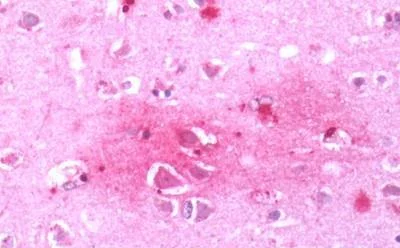 Immunohistochemistry (Formalin/PFA-fixed paraffin-embedded sections) - Anti-CRF1/CRHR1 antibody - N-terminal (AB230803)