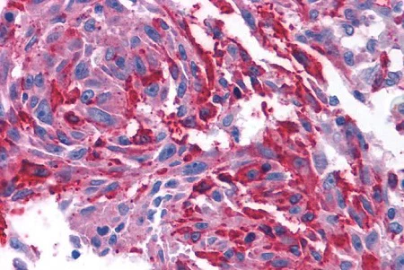 Immunohistochemistry (Formalin/PFA-fixed paraffin-embedded sections) - Anti-CRF1/CRHR1 antibody - N-terminal (AB230803)