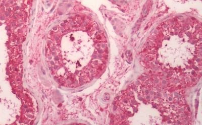 Immunohistochemistry (Formalin/PFA-fixed paraffin-embedded sections) - Anti-CRF1/CRHR1 antibody - N-terminal (AB230803)
