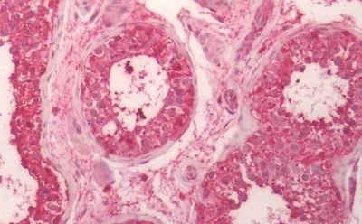 Immunohistochemistry (Formalin/PFA-fixed paraffin-embedded sections) - Anti-CRF1/CRHR1 antibody - N-terminal (AB230803)