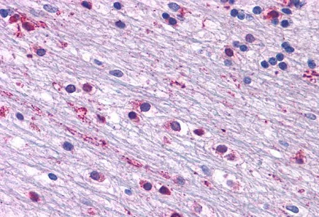 Immunohistochemistry (Formalin/PFA-fixed paraffin-embedded sections) - Anti-CRF1/CRHR1 antibody - N-terminal (AB230803)