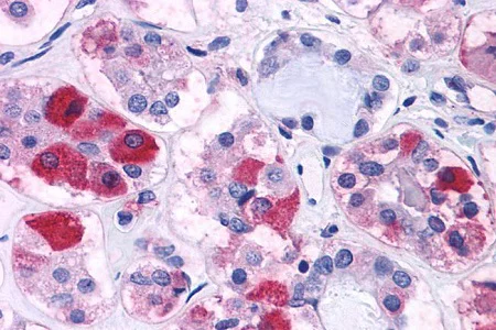 Immunohistochemistry (Formalin/PFA-fixed paraffin-embedded sections) - Anti-CRF1/CRHR1 antibody - N-terminal (AB230803)