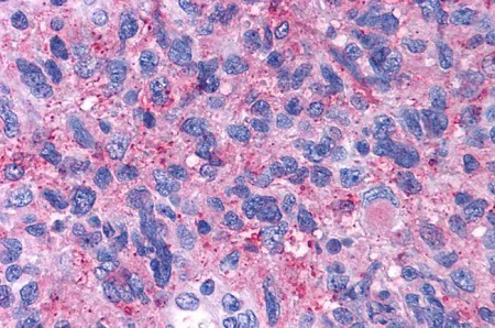 Immunohistochemistry (Formalin/PFA-fixed paraffin-embedded sections) - Anti-CRF1/CRHR1 antibody - N-terminal (AB230803)