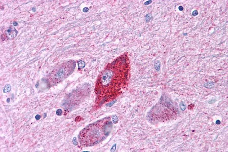 Immunohistochemistry (Formalin/PFA-fixed paraffin-embedded sections) - Anti-CRF1/CRHR1 antibody - N-terminal (AB230803)