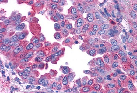 Immunohistochemistry (Formalin/PFA-fixed paraffin-embedded sections) - Anti-CRF1/CRHR1 antibody - N-terminal (AB230803)