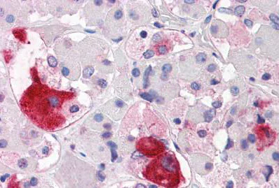 Immunohistochemistry (Formalin/PFA-fixed paraffin-embedded sections) - Anti-CRHR2 antibody (AB150510)