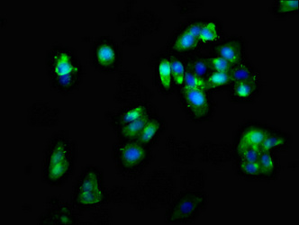 Immunocytochemistry/ Immunofluorescence - Anti-CRHR2 antibody (AB236982), expandable thumbnail