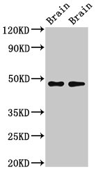 Western blot - Anti-CRHR2 antibody (AB236982), expandable thumbnail