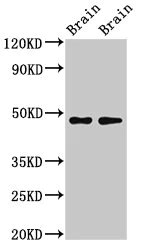Western blot - Anti-CRHR2 antibody (AB236982)