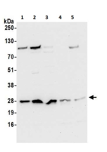 Western blot - Anti-CRIF1 antibody (AB226244)