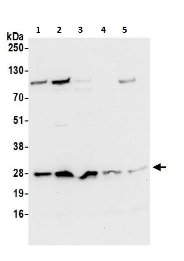 Western blot - Anti-CRIF1 antibody (AB226244)
