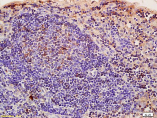 Immunohistochemistry (Formalin/PFA-fixed paraffin-embedded sections) - Anti-CRIM1 antibody (AB214292)