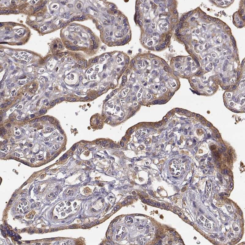Immunohistochemistry (Formalin/PFA-fixed paraffin-embedded sections) - Anti-CRIM1 antibody (AB272542), expandable thumbnail
