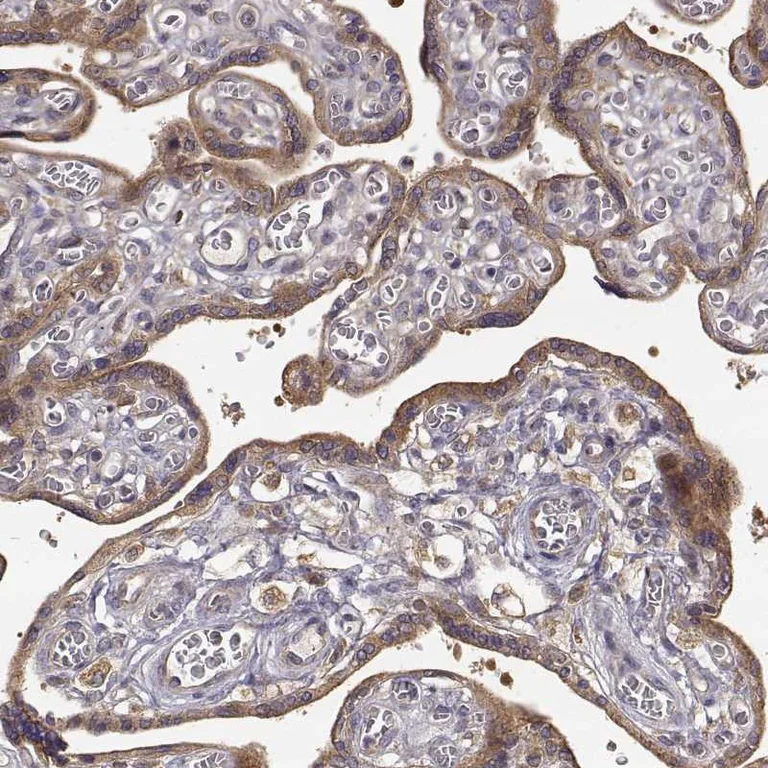 Immunohistochemistry (Formalin/PFA-fixed paraffin-embedded sections) - Anti-CRIM1 antibody (AB272542)