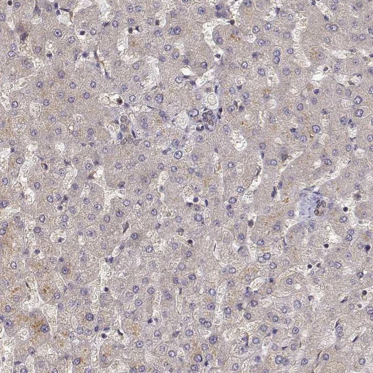 Immunohistochemistry (Formalin/PFA-fixed paraffin-embedded sections) - Anti-CRIM1 antibody (AB272542)