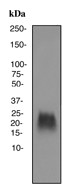 Western blot - Anti-Cripto1/CRIPTO antibody [EPNCIR106A] (AB108391), expandable thumbnail