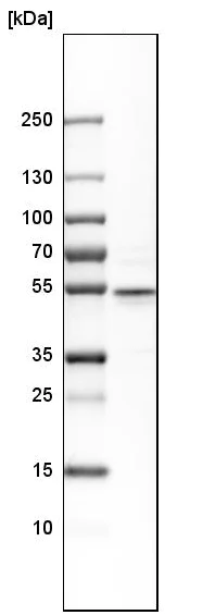 Western blot - Anti-CRISPLD2 antibody (AB224136)