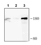 Immunoprecipitation - Anti-CRISPR-Cas9 antibody (AB204448)