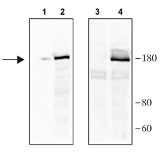 Western blot - Anti-CRISPR-Cas9 antibody (AB204448)