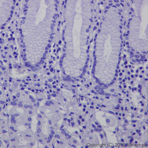 Immunohistochemistry (Formalin/PFA-fixed paraffin-embedded sections) - Anti-CRISPR-Cas9 antibody [EPR18991] (AB189380)