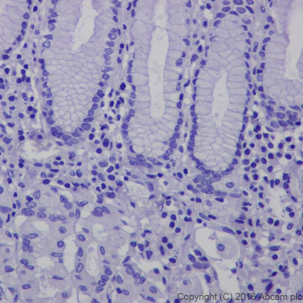 Immunohistochemistry (Formalin/PFA-fixed paraffin-embedded sections) - Anti-CRISPR-Cas9 antibody [EPR18991] (AB189380)