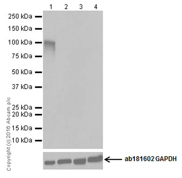 Western blot - Anti-CRISPR-Cas9 antibody [EPR19619-18] (AB202637)