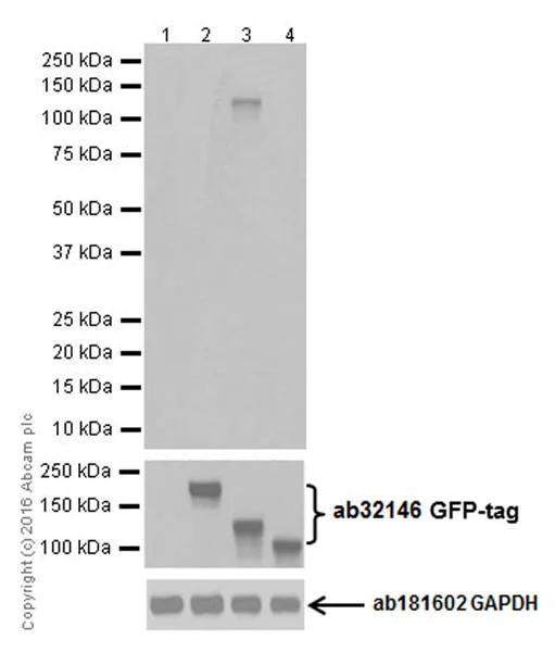 Western blot - Anti-CRISPR-Cas9 antibody [EPR19619-18] (AB202637)