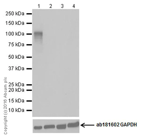 Western blot - Anti-CRISPR-Cas9 antibody [EPR19619-92] (AB210752)