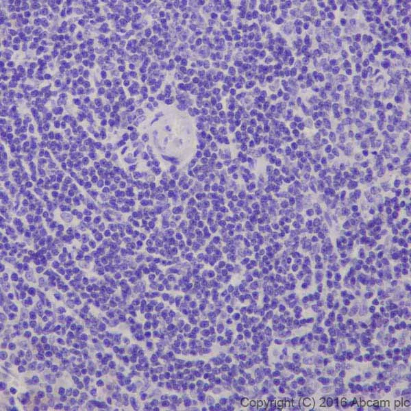 Immunohistochemistry (Formalin/PFA-fixed paraffin-embedded sections) - Anti-CRISPR-Cas9 antibody [EPR19620] (AB202638)