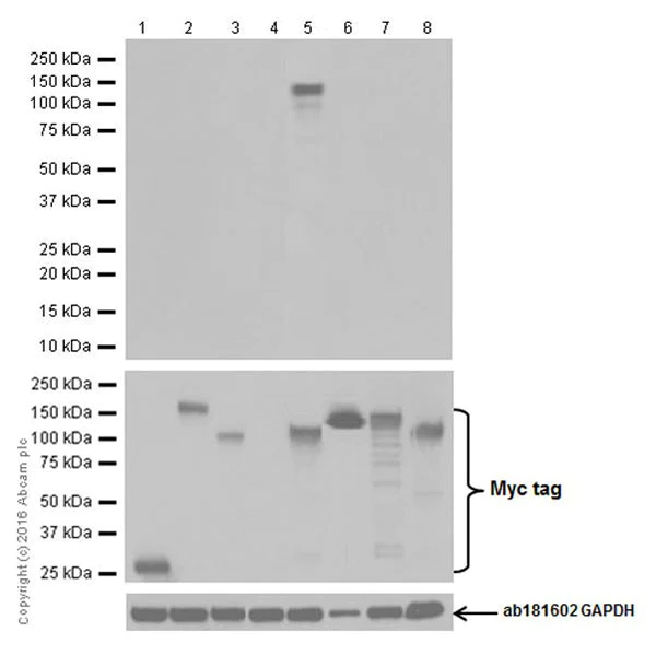 Western blot - Anti-CRISPR-Cas9 antibody [EPR19620] (AB202638)