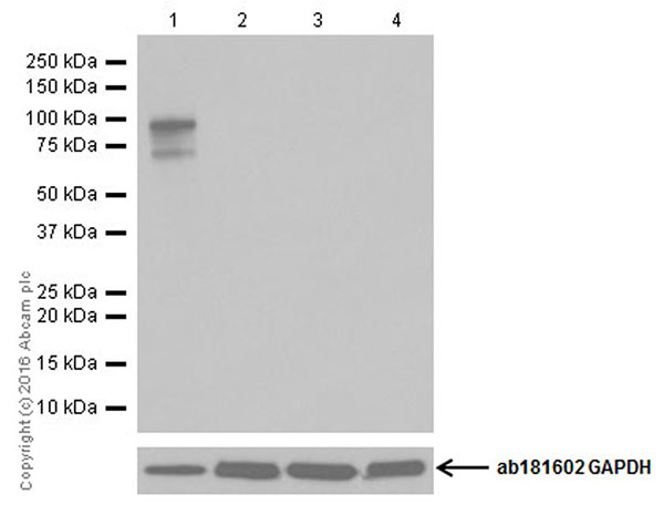 Western blot - Anti-CRISPR-Cas9 antibody [EPR19633] (AB202657), expandable thumbnail