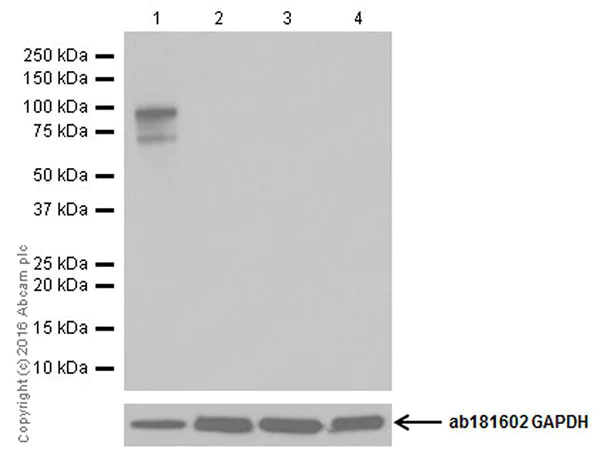 Western blot - Anti-CRISPR-Cas9 antibody [EPR19633] (AB202657)