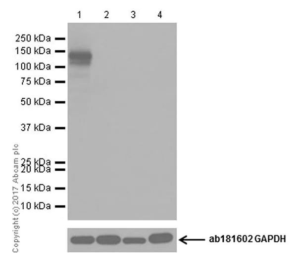 Western blot - Anti-CRISPR-Cas9 antibody [EPR19795] (AB203943)