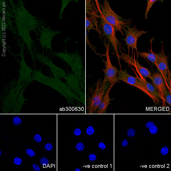 Immunocytochemistry/ Immunofluorescence - Anti-Crk p38 antibody [22/Crk] (AB300630), expandable thumbnail