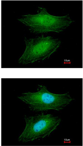 Immunocytochemistry/ Immunofluorescence - Anti-CrkL antibody (AB151791), expandable thumbnail