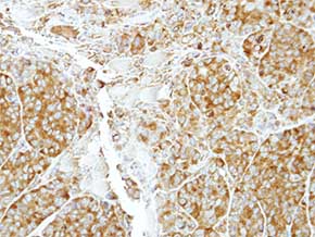 Immunohistochemistry (Formalin/PFA-fixed paraffin-embedded sections) - Anti-CrkL antibody (AB151791), expandable thumbnail