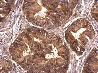 Immunohistochemistry (Formalin/PFA-fixed paraffin-embedded sections) - Anti-CrkL antibody (AB151791)