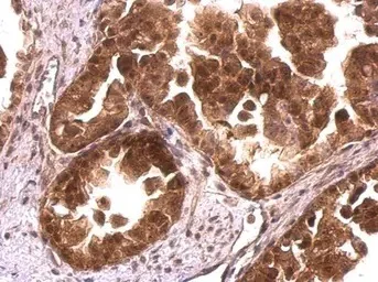 Immunohistochemistry (Formalin/PFA-fixed paraffin-embedded sections) - Anti-CrkL antibody (AB151791)