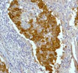 Immunohistochemistry (Formalin/PFA-fixed paraffin-embedded sections) - Anti-CrkL antibody [Y243] (AB32126)