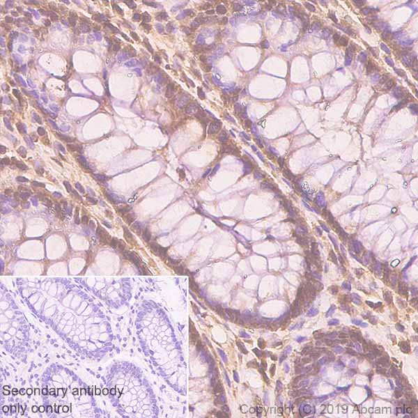 Immunohistochemistry (Formalin/PFA-fixed paraffin-embedded sections) - Anti-CrkL antibody [Y244] (AB32018), expandable thumbnail