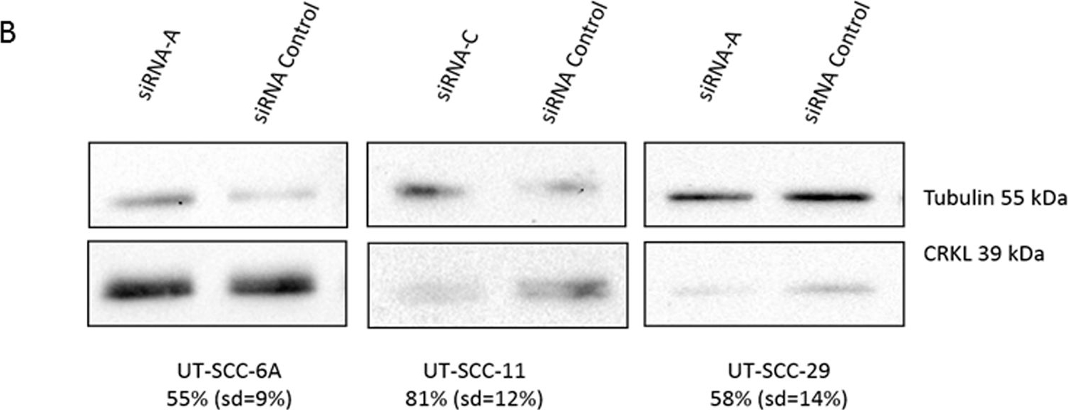 Western blot - Anti-CrkL antibody [Y244] (ab32018), expandable thumbnail