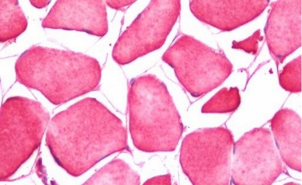 Immunohistochemistry (Formalin/PFA-fixed paraffin-embedded sections) - Anti-CRLF1 antibody (AB211438)